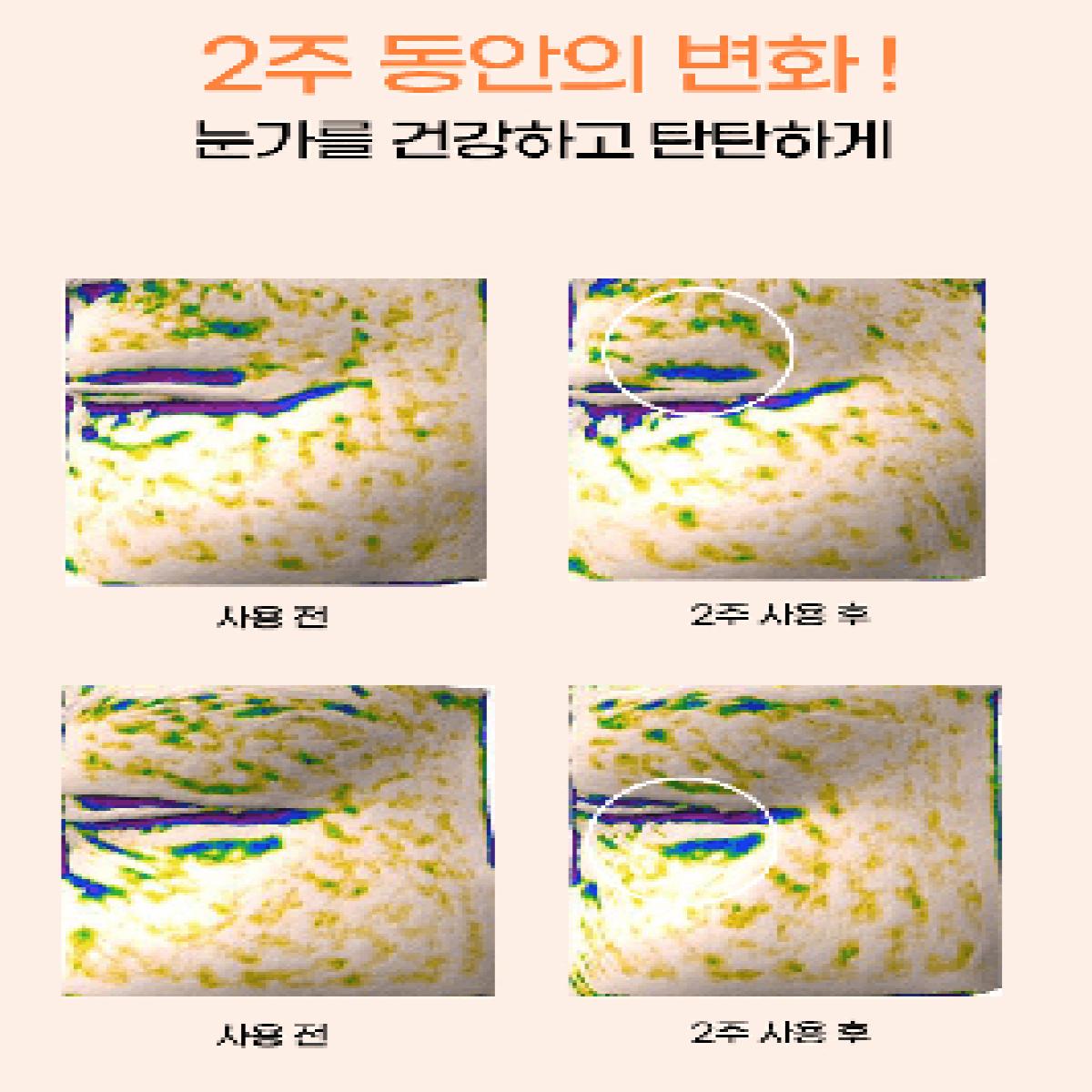 산뜻한 보습 마유마유 멀티밤 미백&주름 개선 2중기능